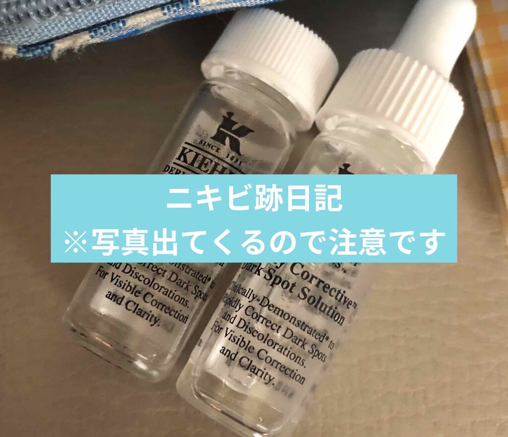 キールズ Ds クリアリーホワイト ブライトニング エッセンス Kiehl Sを使った口コミ ずっと載せようと思っていたニキビ跡日記 お By サーモン 混合肌 代前半 Lips