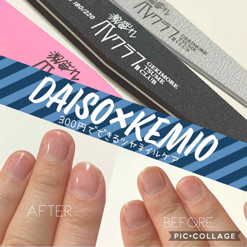 激盛れ爪クラブ Daisoの口コミ 超優秀 100均で買えるおすすめネイル用品 ネイルngの学校 職場 By 駒 乾燥肌 Lips