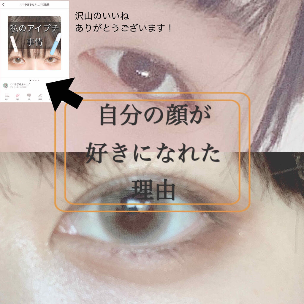 二重になる方法 のび る アイテープ 絆創膏タイプ Daisoの使い方や二重メイク 私のアイプチ事情の投稿 By やぎろん アトピー肌 20代前半 Lips