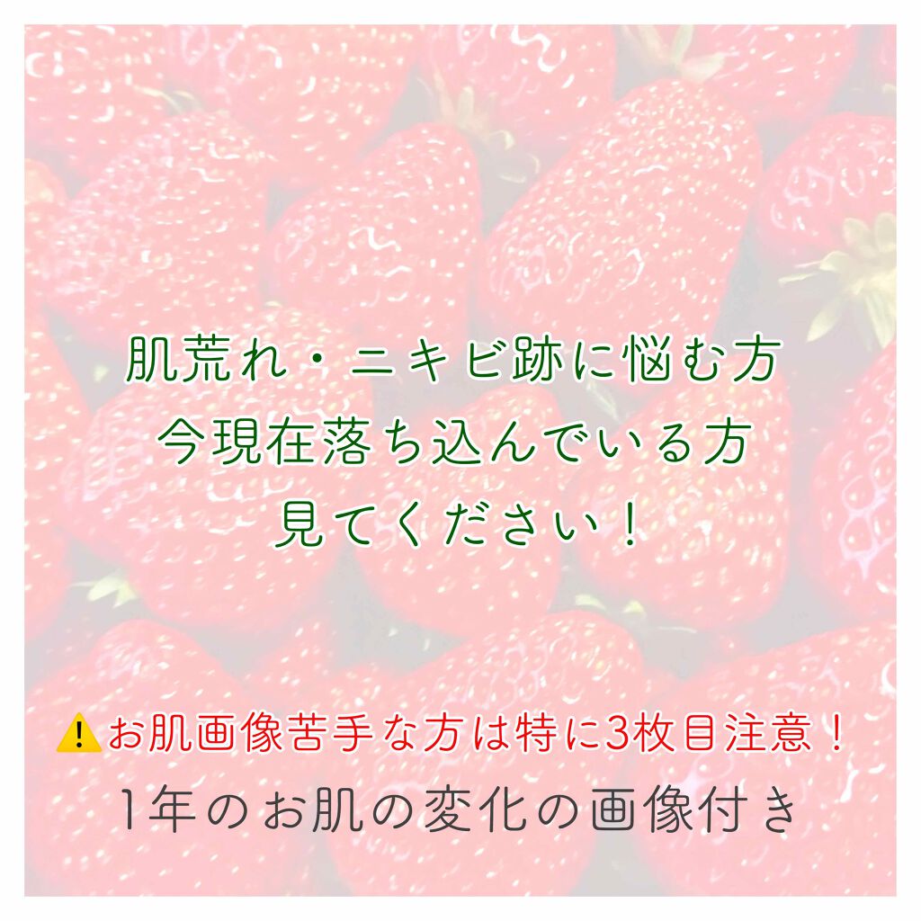 ビジャ シカバーム Ex Innisfreeの口コミ 現在ニキビ ニキビ跡に悩むそこの乙女 これ By Kirari 敏感肌 10代後半 Lips