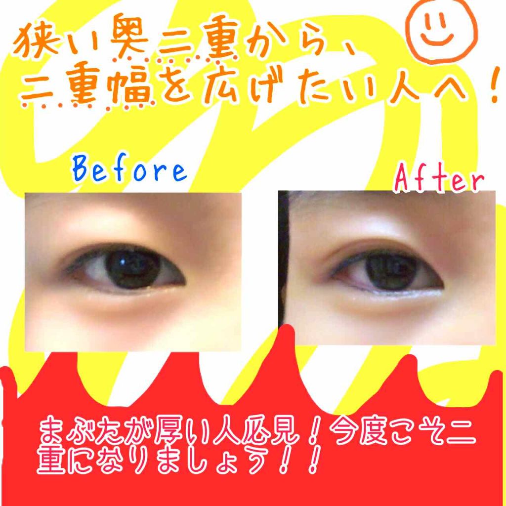 アイトーク アイトークの口コミ 初投稿です 初回は 私流の二重の仕方につい By すいか Lips