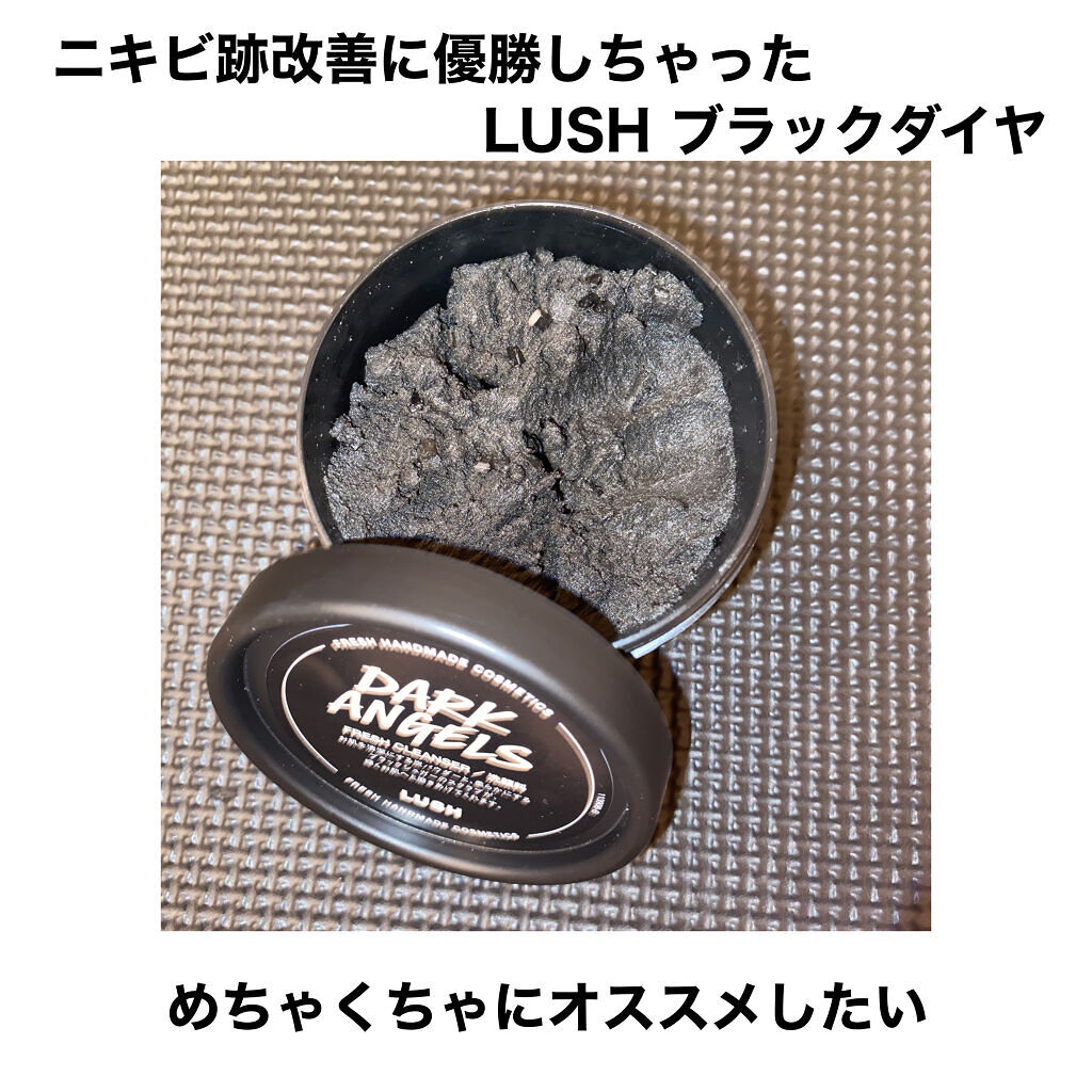 ブラックダイヤ ラッシュの使い方を徹底解説 ニキビ跡改善プログラム第1弾1つ1つ細かく By ハミガキ娘 混合肌 代前半 Lips