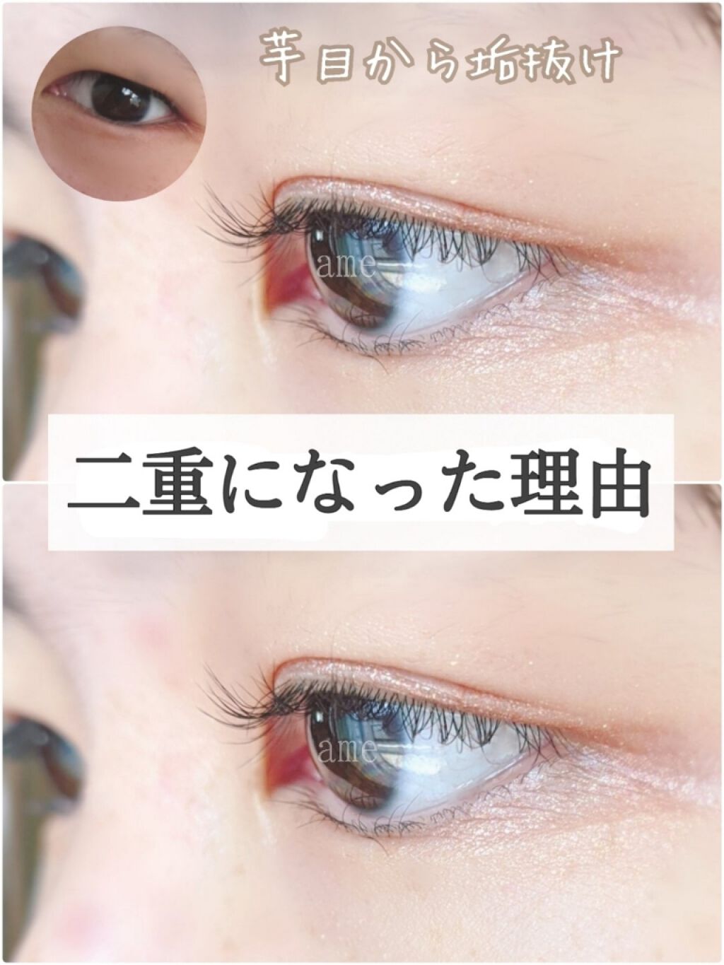 二重になる方法 アイトーク アイトークの使い方や二重メイク 二重になった理由 頑 By 雨 梅 混合肌 10代後半 Lips