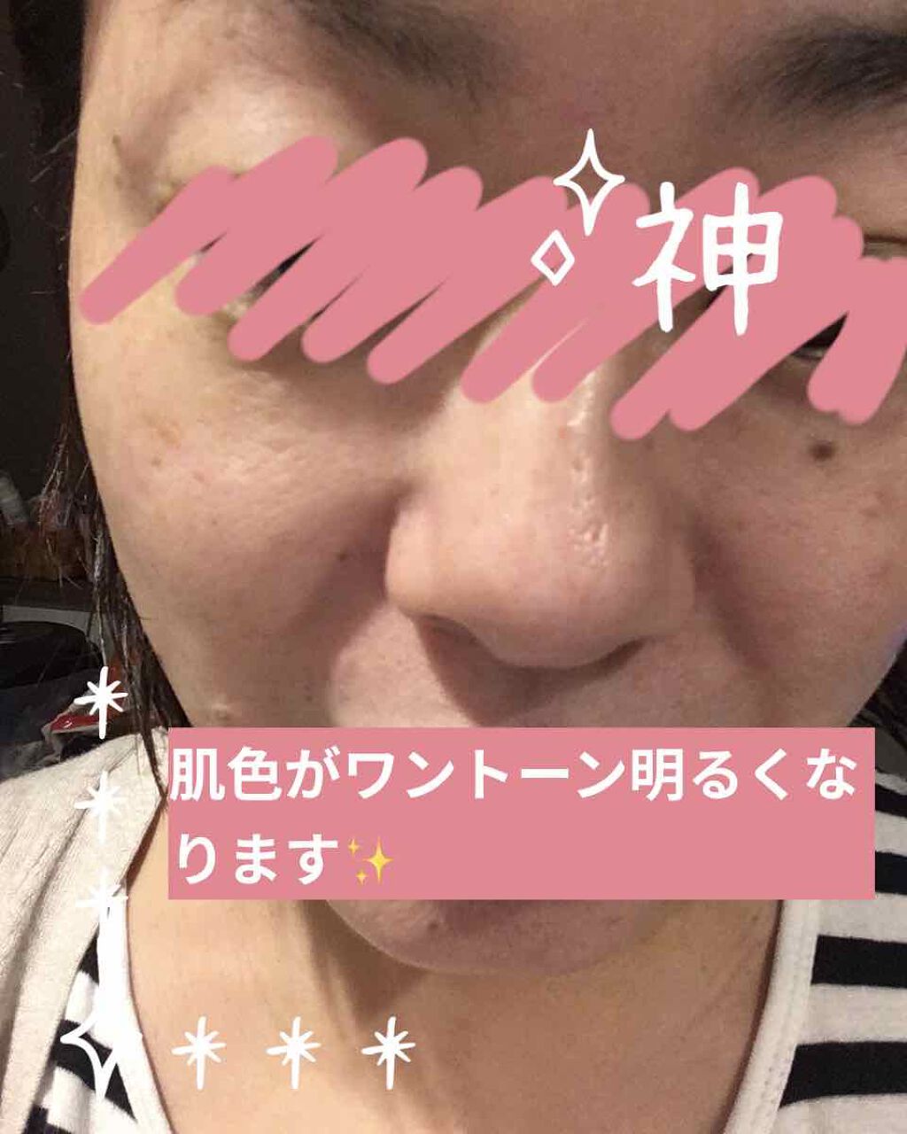 いいじゃんガスール石鹸 イーキューブの口コミ 肌がワントーン明るくなります これまでは By ユマチカ 混合肌 40代後半 Lips