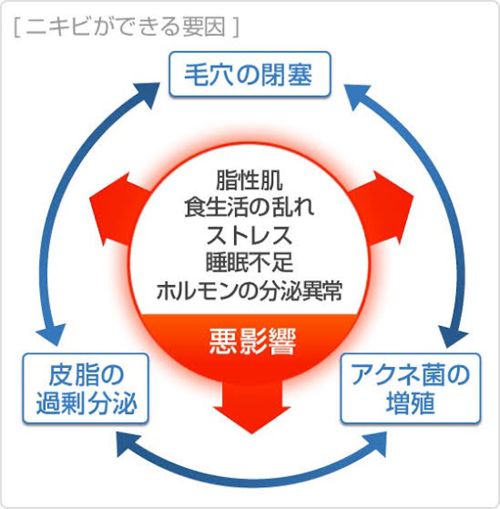 スキンケア方法 ミノン アミノモイスト モイストチャージ ミルク ミノンの使い方 効果 ニキビに打ち勝て By 𓌉 𓇋ルナ𓌉 𓇋 乾燥肌 20代前半 Lips