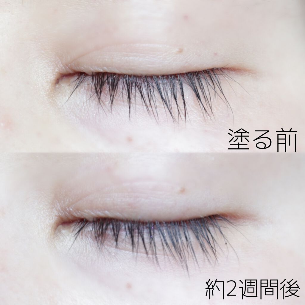 アイラッシュセラム Seimeiの効果に関する口コミ 敏感肌におすすめのまつげ美容液 常識を覆す次世代超濃 By Haruka 乾燥肌 30代後半 Lips