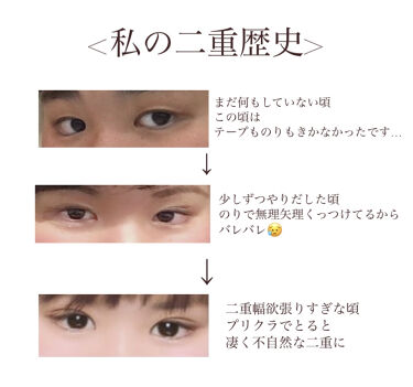 二重になる方法 のび る アイテープ 両面テープタイプ Daisoの使い方や二重メイク 一重に悩まされていた By Miya Lips