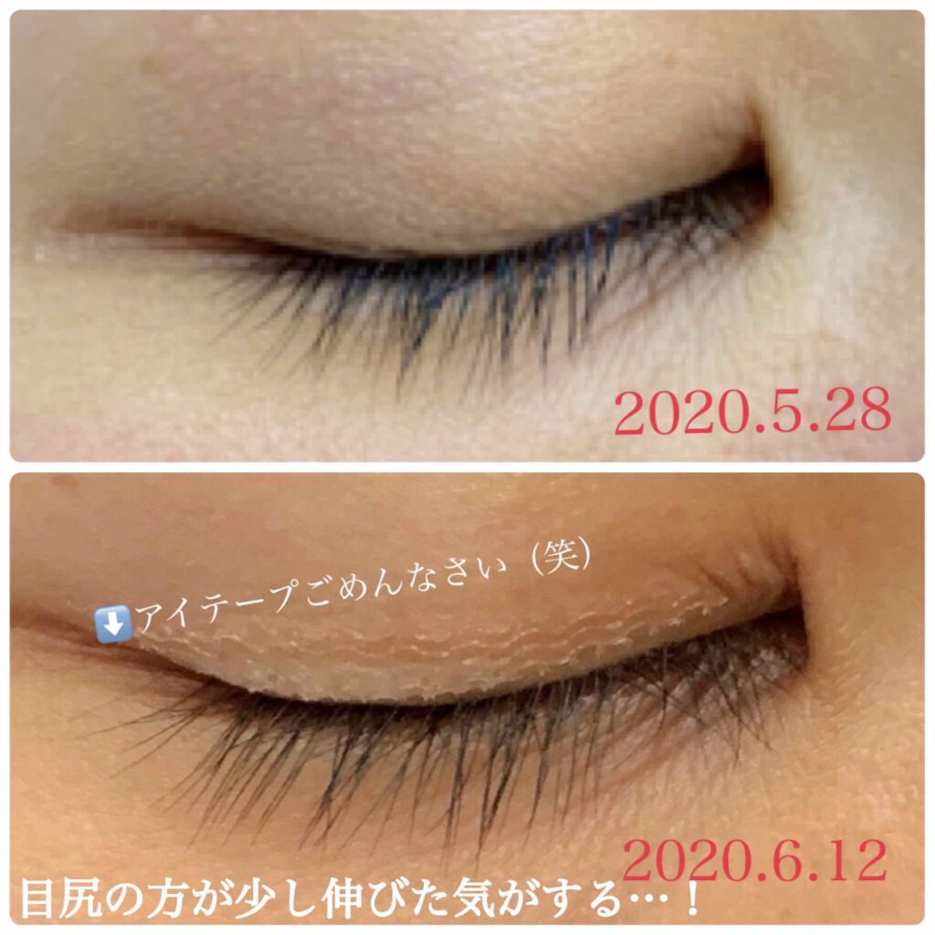 アピール かなりの 気怠い エマーキット 充血 Sakonaka Jp