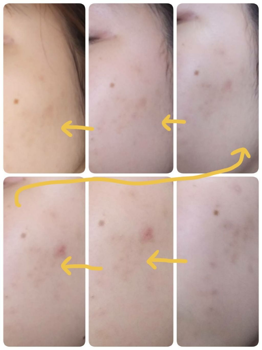 お米のマスク 毛穴撫子を使った口コミ ニキビとあんまり関係のない生活をしていたの By シャイニング 混合肌 代前半 Lips