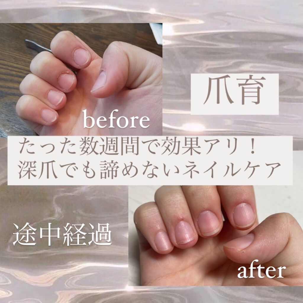 ハンドベール プレミアムリッチネイル メンソレータムを使った口コミ 深爪でも諦めない 私のネイルケア はじ By Oxydoll 混合肌 10代後半 Lips