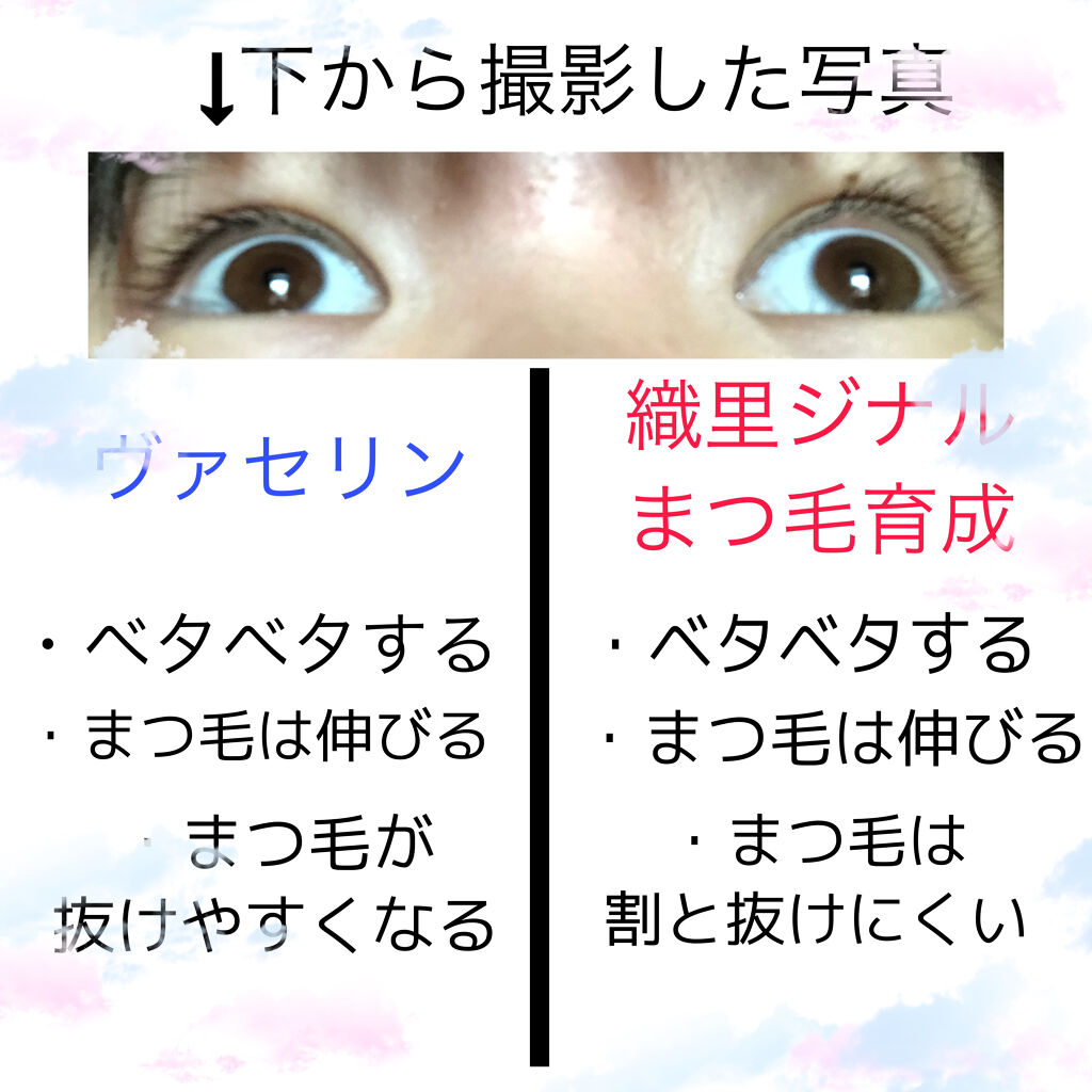 オリジナル ピュアスキンジェリー ヴァセリンを使った口コミ おはようございますこんにちはこんばんは織里 By 織里 オリ 3月まで投稿 脂性肌 10代後半 Lips
