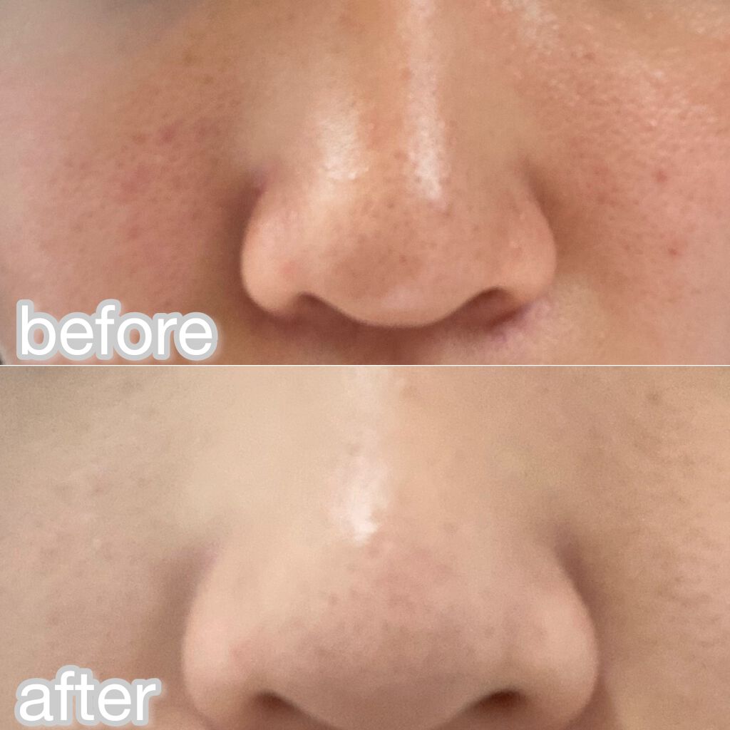 スキンケア方法 めくるコットン コットン ラボの使い方 効果 いちご鼻改善方法 い By める 乾燥肌 Lips