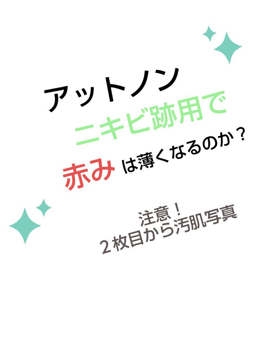 ニキビあとケアジェル アットノンの口コミ 自分の記録用にもなればと思い 言葉がちょっ By Aren Lips