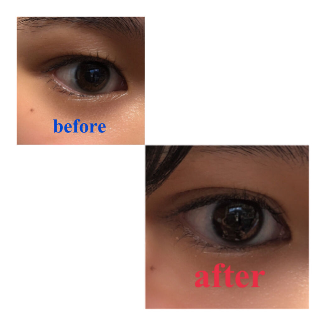 二重になる方法 クリップカッター メザイクの使い方や二重メイク 簡単に二重幅を広げる方 By Minguri Lips