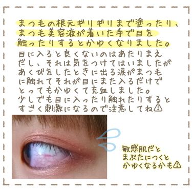 ラッシュ セラム ロレアル パリの効果に関する口コミ 敏感肌におすすめのまつげ美容液 ロレアルパリラッシュセ By 無名 20代前半 Lips