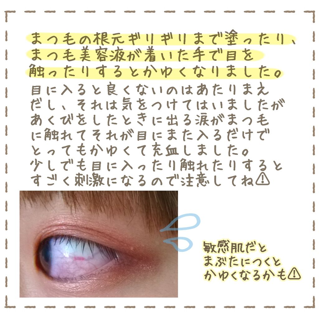 ラッシュ セラム ロレアル パリの効果に関する口コミ 敏感肌におすすめのまつげ美容液 ロレアルパリラッシュセ By 無名 代前半 Lips