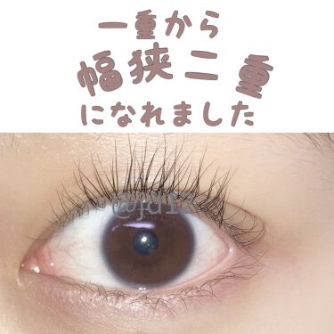 二重まぶた用シール Daisoの口コミ 超優秀 100均で買えるおすすめ二重まぶた用アイテム 一重 三重 が二重に By 春から大学生 フォロバ 乾燥肌 10代後半 Lips