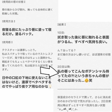 リップケア バーム 医薬部外品 キュレルの使い方を徹底解説 唇が荒れ荒れの状態でガチで試しました 結果 By ひいらぎ 乾燥肌 Lips