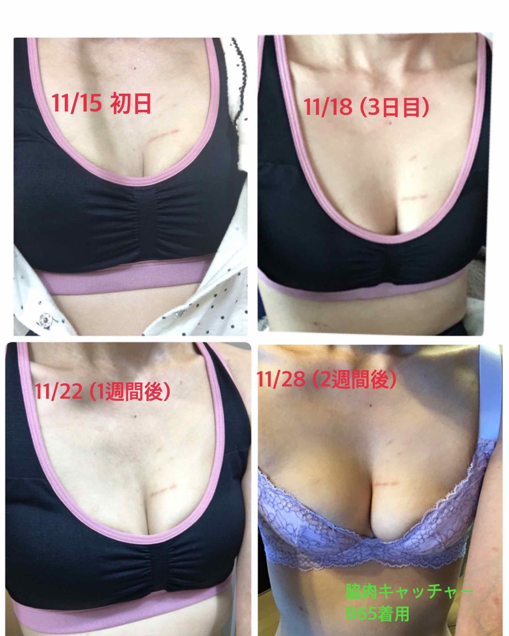 モテフィット ふっくらバストメイクブラ キレイノワの画像 動画一覧 2ページ目 Lips