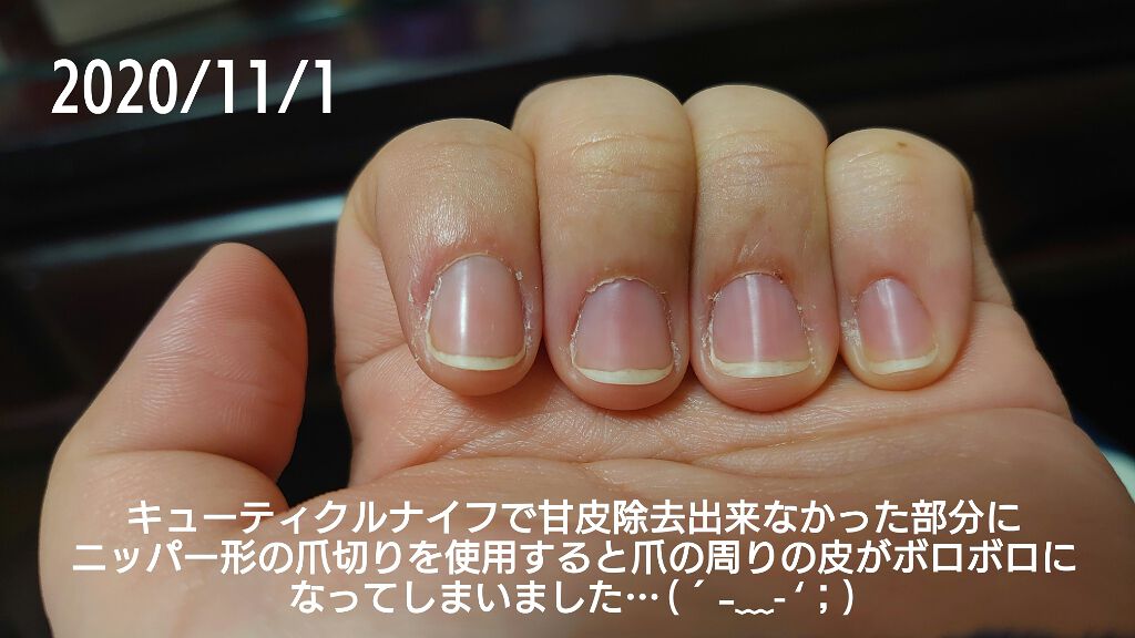 ディープセラム Dr Nailを使った口コミ 1ヶ月経過したので経過報告をまとめます By ヒバリヤ 混合肌 代後半 Lips