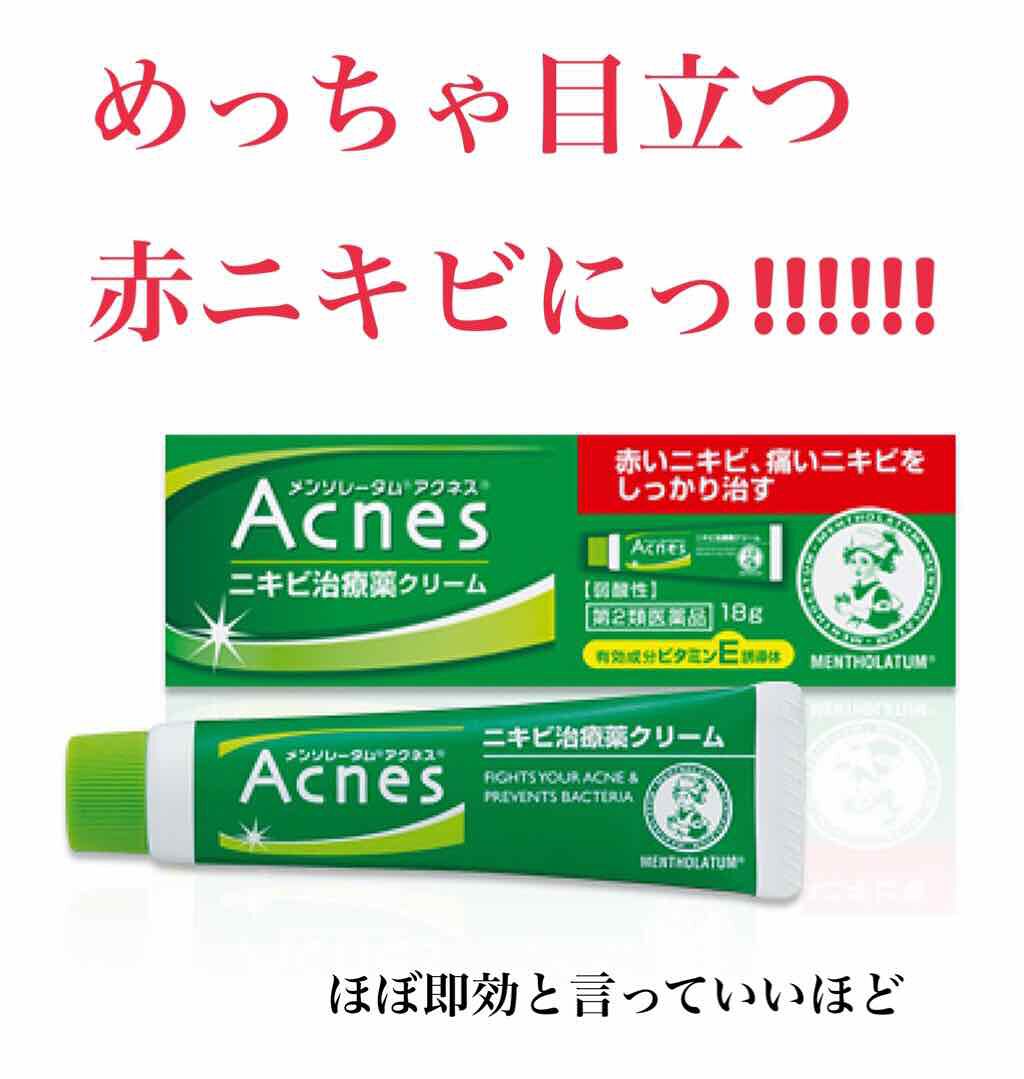 ニキビ治療薬(医薬品)｜メンソレータム アクネスの口コミ「『うわっ、赤ニキビ、、🥺』なあなた!!!め..」 by ぴぐ(脂性肌) LIPS
