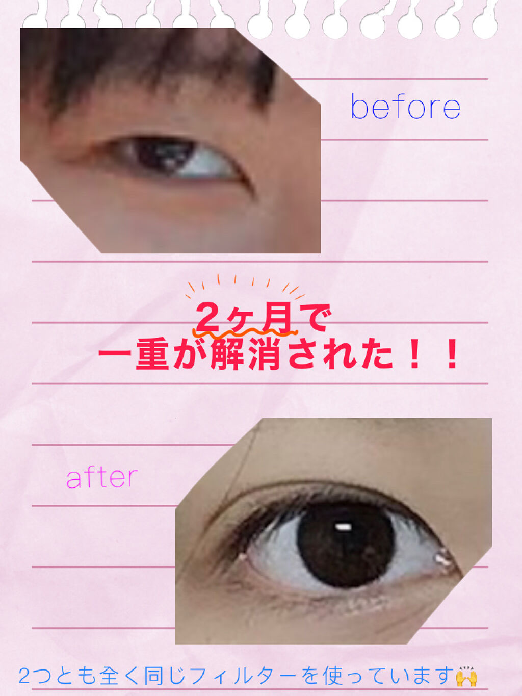 二重になる方法 ダブルアイリッド Daisoの使い方や二重メイク 実質0円で一重解消 By Y K 敏感肌 Lips