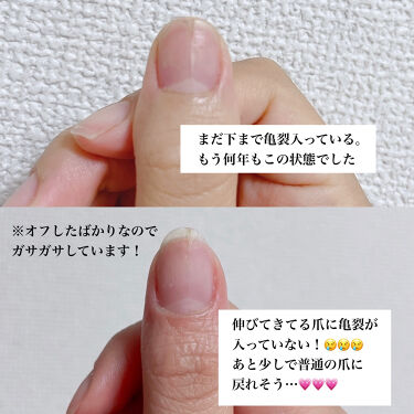 デイケアオイル Dr Nailの口コミ 爪の縦線亀裂で悩んでいる方へ 是非ご覧くだ By R E N A𓂃𓈒𓏸 混合肌 代後半 Lips