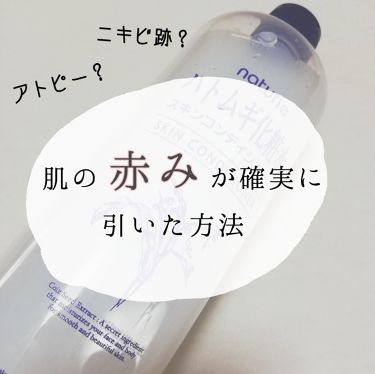 配列 理由 インフラ ハトムギ 化粧 水 ニキビ 跡 赤み Trytrytryathlete Com