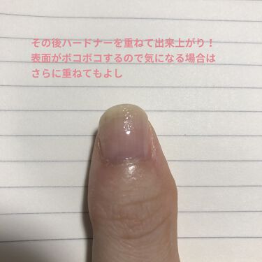 ネイルサポートn ネイルネイルを使った口コミ 育爪中 甘皮処理が楽しくなっちゃって爪の根 By Kn 乾燥肌 代後半 Lips