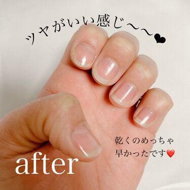 Muu フォロバ100 On Lips 学校や仕事でネイルできない方必見 すっぴん風美爪になれちゃい Lips