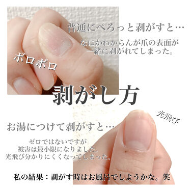 ジェルネイルシール キャンドゥの口コミ 超優秀 100均で買えるおすすめネイルシール パーツ 学生やバイトや仕事でネ By ひかる 乾燥肌 代前半 Lips