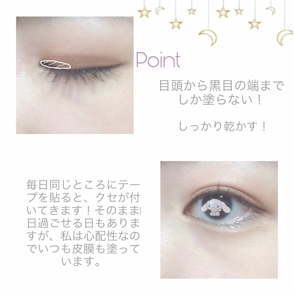 のび る アイテープ 絆創膏タイプ Daisoを使った口コミ いきなりですが 私はものすごく一重です 瞼 By Koto Lips
