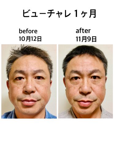 フェイス ポインター リフトアップを叶えてくれる美顔器おすすめ10選 1日数分でめざせ サロンクオリティ Amp Petmd Com