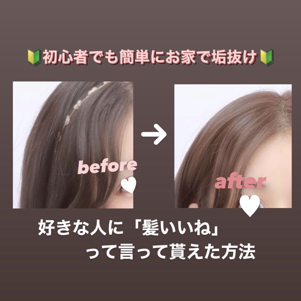 ビューティラボ ホイップヘアカラー 泡タイプ ビューティラボの口コミ お家で簡単に染められる ビューティラボホ By ぴぴぴのぴ 混合肌 10代後半 Lips