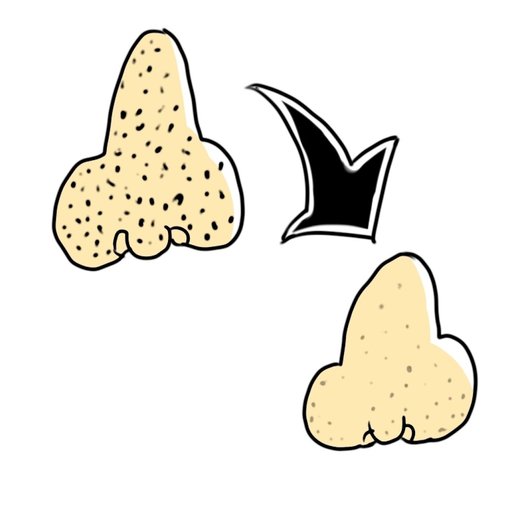 ロゼット洗顔パスタ アクネクリア ロゼットの口コミ ニキビに加えてヤツも撃退できる こんばん By みりん 敏感肌 10代後半 Lips