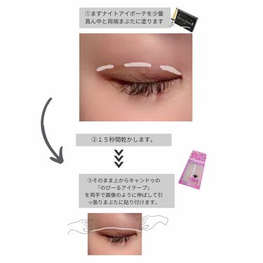 二重になる方法 ナイトアイボーテ Streetrendの使い方や二重メイク 今回は私が一重から二重 By まき 普通肌 代前半 Lips