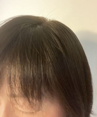 頭皮が硬いと白髪やはげる原因に 1分でできる頭皮マッサージやおすすめグッズをご紹介 Lips 頭皮が硬いと白髪やはげる原因に 1分でできる頭皮マッサージやおすすめグッズをご紹介 Lips
