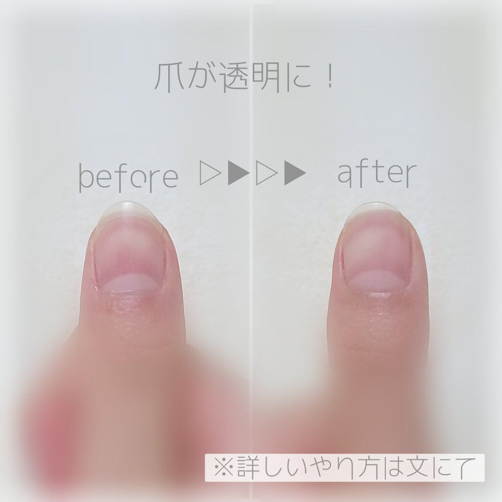 爪の細部も磨きやすい爪みがき 立体タイプ ウォーターライトg E の画像 動画一覧 Lips