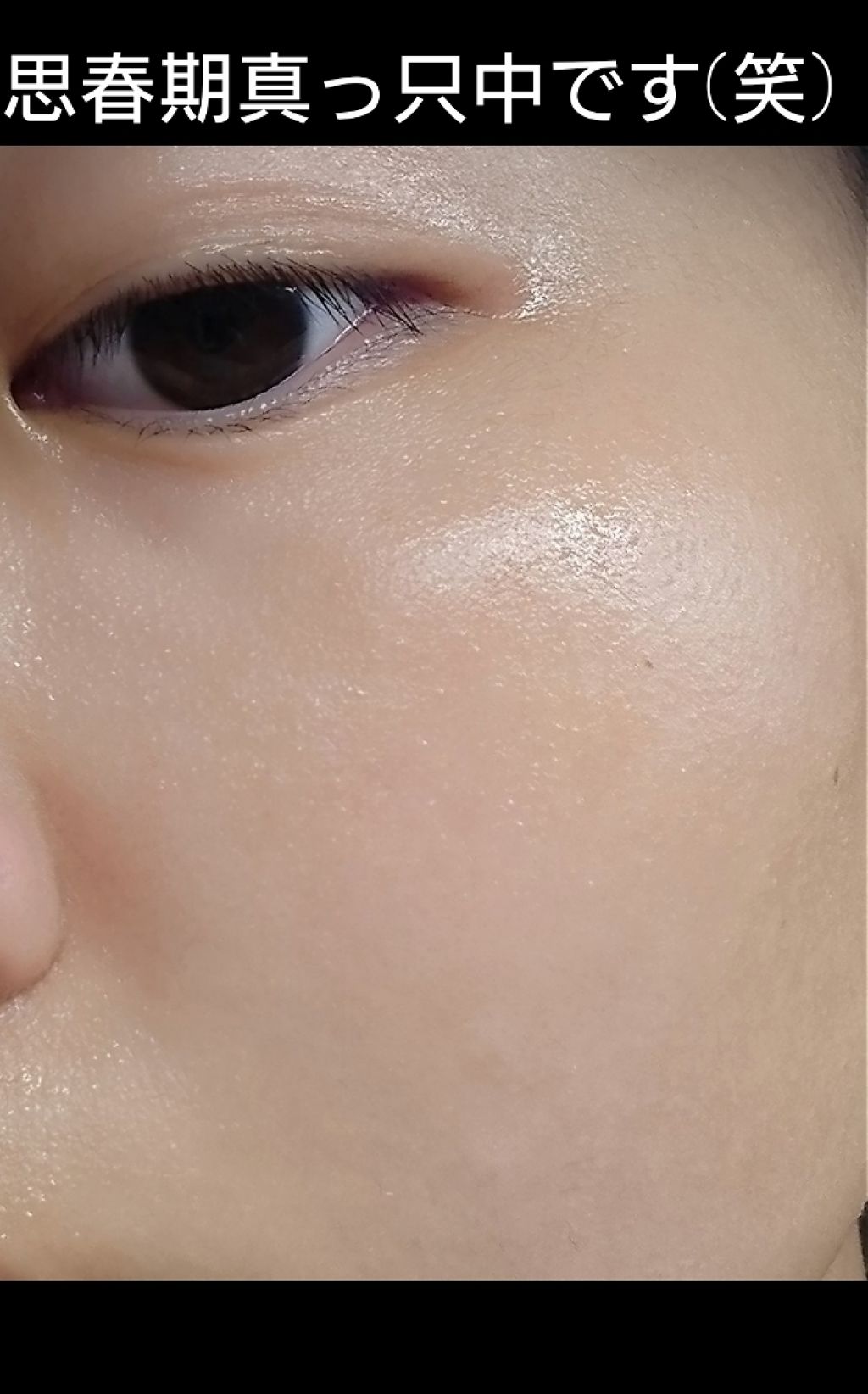 すっぴんべっぴん黒石けん ていねい通販の口コミ 敏感肌におすすめの洗顔石鹸 こんにちは 29猫です By 29猫 乾燥肌 Lips