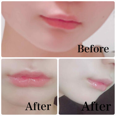 ラシャスリップス ラシャスリップの使い方を徹底解説 塗るヒアルロン酸注射 レビュー 今回紹介す By Riii 乾燥肌 代前半 Lips