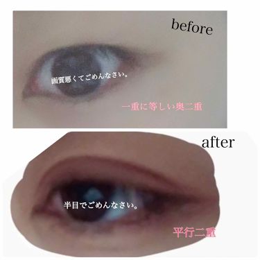 二重になる方法 絆創膏 Daisoの使い方や二重メイク 初投稿です 私は今高校 By がちゃみん Lips