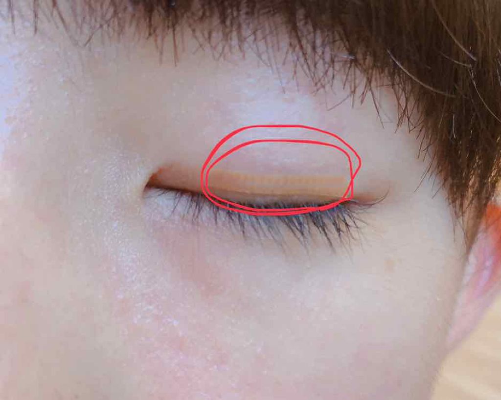 救急ばんそうこう ドン キホーテの口コミ 今日は 私が家でやっているアイプチのやり方 By 普通の中学生 敏感肌 Lips