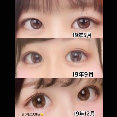 アイトーク アイトークの口コミ 激ブス一重女子が二重になって人生変わった理 By Koni 普通肌 Lips