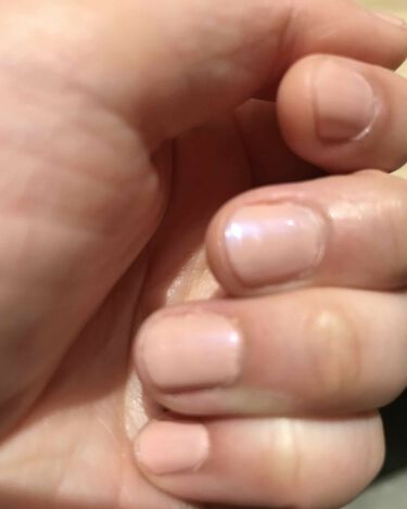 ネールカラー インテグレート グレイシィの口コミ インテグレートグレイシィのネイルrd109 By Yuki アトピー肌 30代前半 Lips