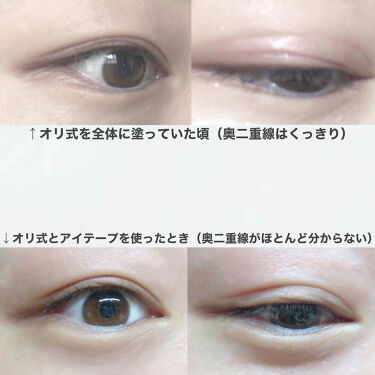 二重になる方法 のび る アイテープ 絆創膏タイプ Daisoの使い方や二重メイク メイクと並行すれば3 By 亜 莉 乾燥肌 10代後半 Lips