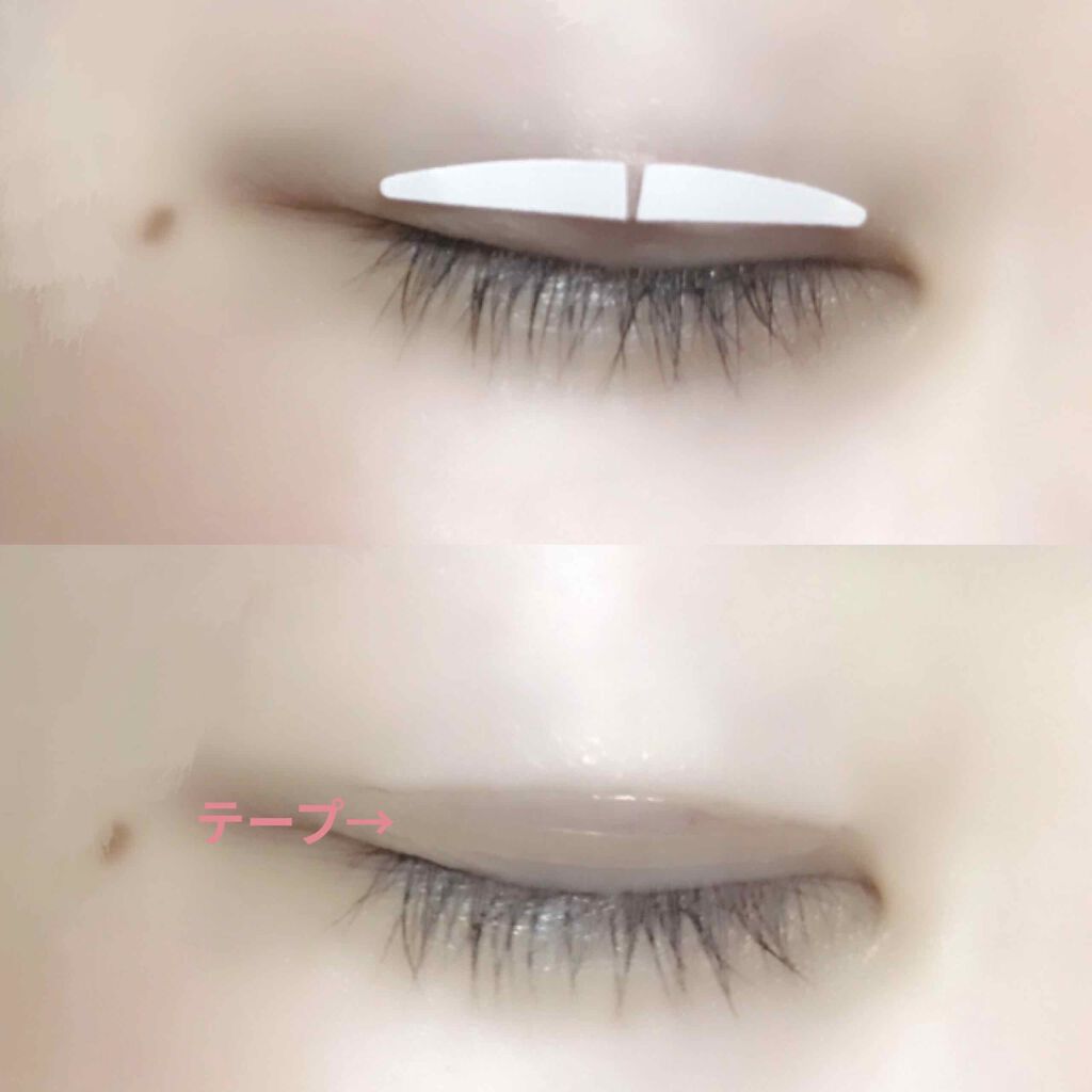 K Lab 韓国美容式アイテープ 夜用 コジットの画像 動画一覧 Lips