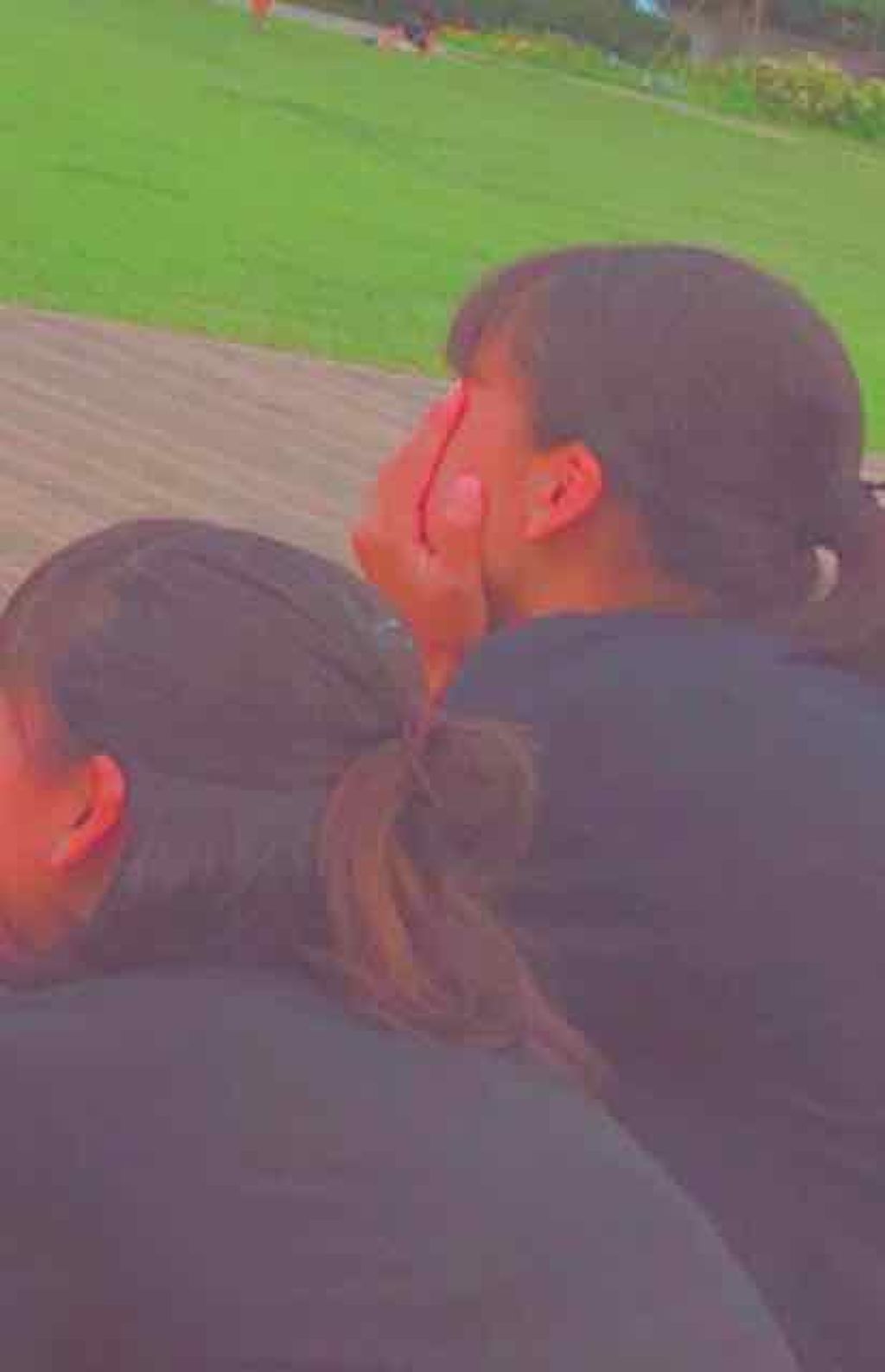 オキシドール 医薬品 日本薬局方の口コミ オキシドール 目指せ Brownhai By あ め り 敏感肌 10代前半 Lips