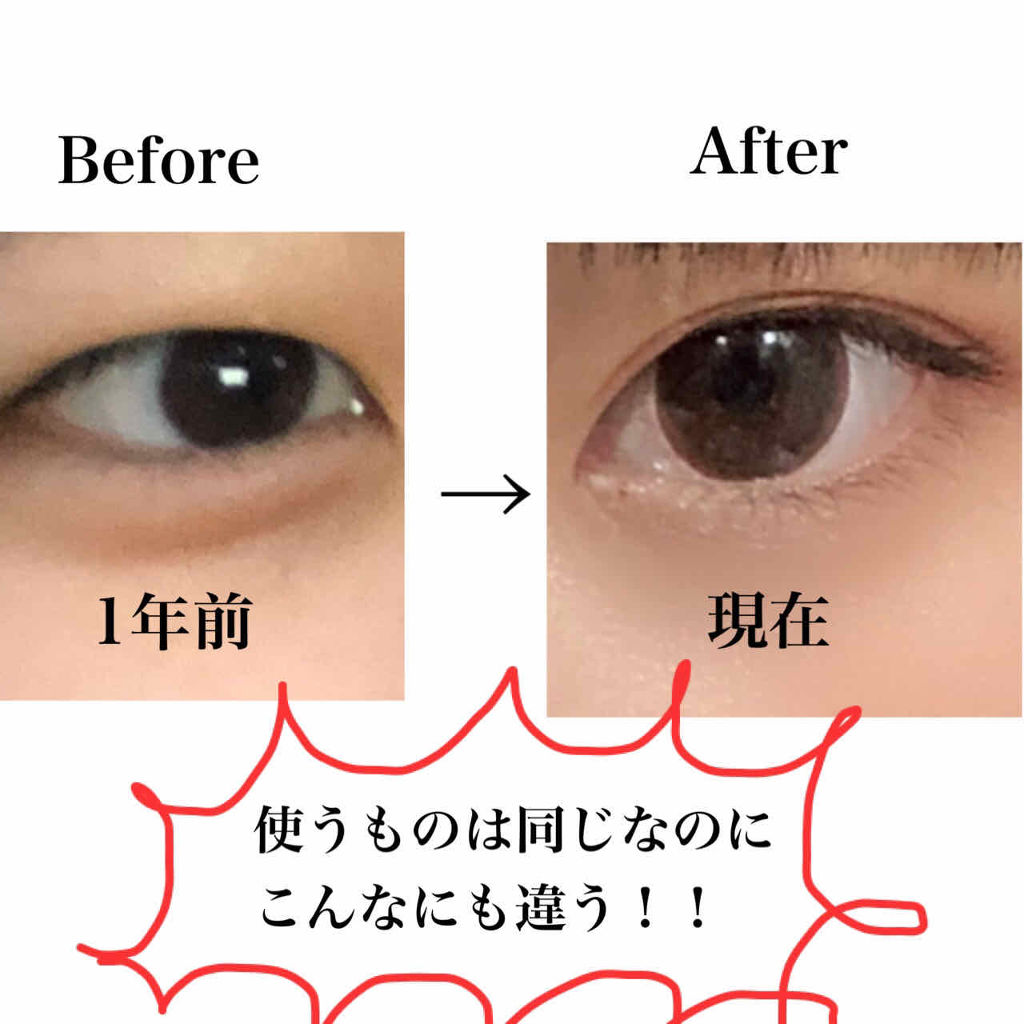 アイビューティーフィクサーwp アストレア ヴィルゴの口コミ 目の大きさが倍になる 皆さんこんばんは By ちゃんみづ 乾燥肌 10代後半 Lips