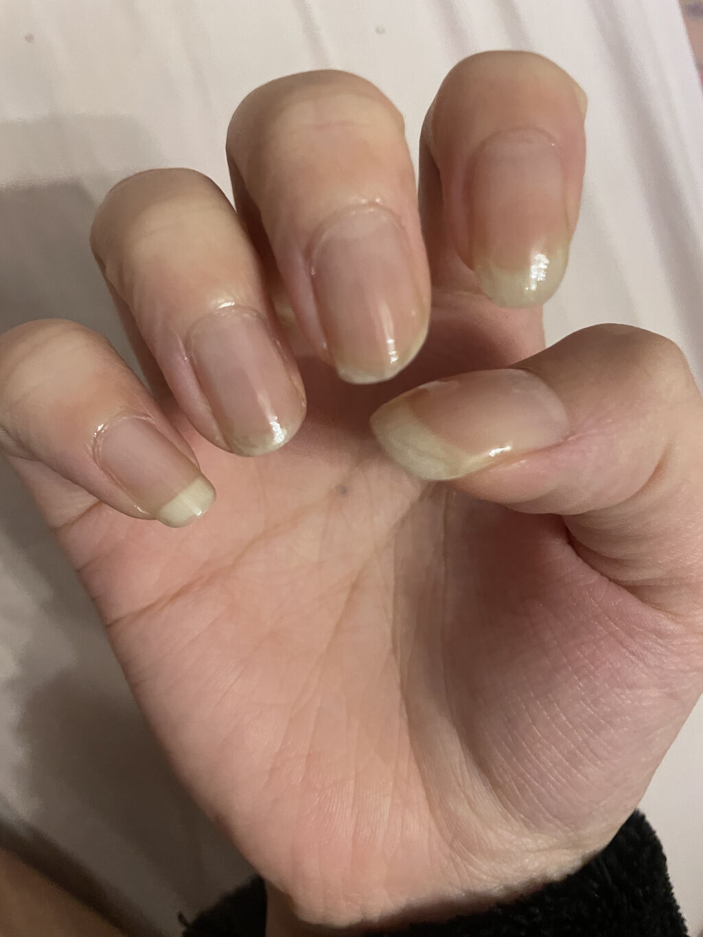 ネイルエンビー O P Iを使った口コミ 私は深爪だからネイルできない 爪を噛む癖 By ナノ 乾燥肌 10代後半 Lips