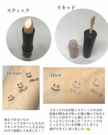 ニキビの隠し方を徹底解説 コンシーラーの使い方やおすすめベースアイテムも 画像付き Lips